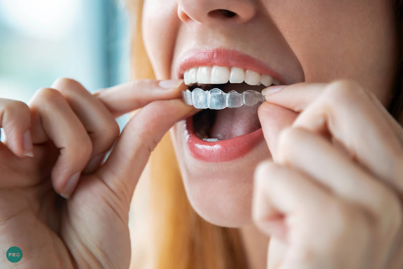 Smiling individual inserting a clear aligner, showcasing an invisible and modern orthodontic solution for teeth straightening, highlighting Invisalign cost in Manassas, VA.